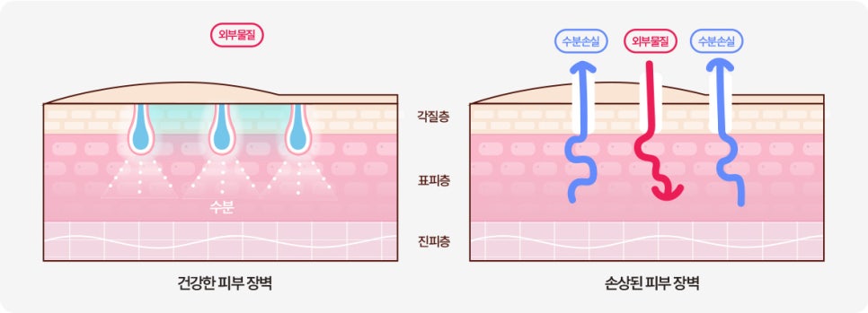 피부장벽 피부장벽