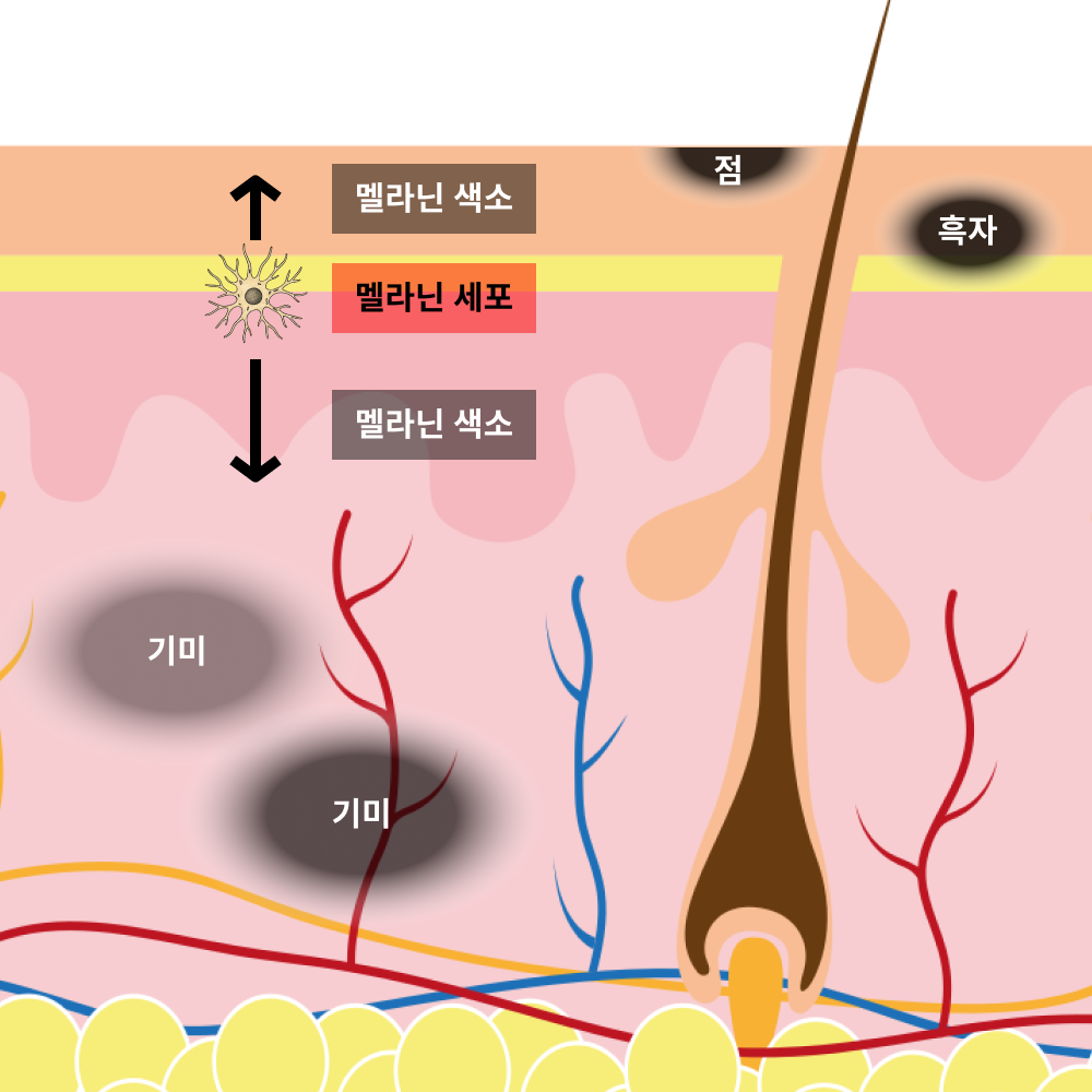 기미, 흑자