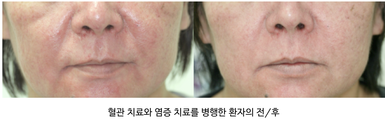 스크린샷 2025-07-23 오후 11.53.54