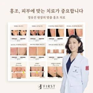 광교 퍼스트피부과 홍조 치료 후기
